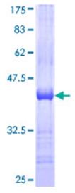 SDS-PAGE (CDH11-0972H).jpg